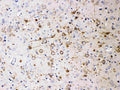 Anti-NEFH Antibody (Monoclonal, N52)