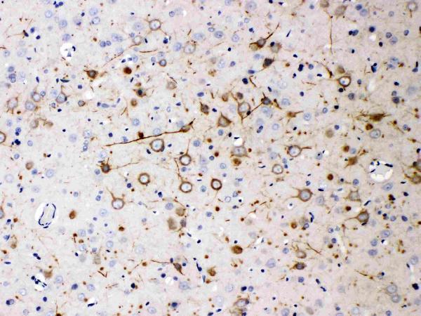Anti-NEFH Antibody (Monoclonal, N52)