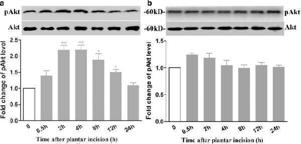 Anti-PKB Alpha Akt1 Antibody (Monoclonal, PKB-175)