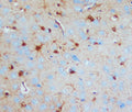 Anti-S-100(beta-subunit) antibody (monoclonal), MA1088, IHC(P)
IHC(P): Rat Brain Tissue Lysate