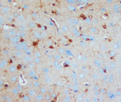 Anti-S-100(beta-subunit) antibody (monoclonal), MA1088, IHC(P)
IHC(P): Rat Brain Tissue Lysate