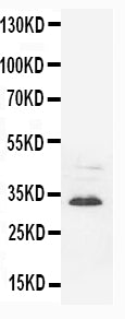 Anti-Synaptophysin antibody (monoclonal), MA1091, Western blotting
WB: Rat Brain Tissue Lysate