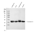 Anti-Tropomyosin(36/39 kDa) Tpm1 Antibody (Monoclonal, TM31)