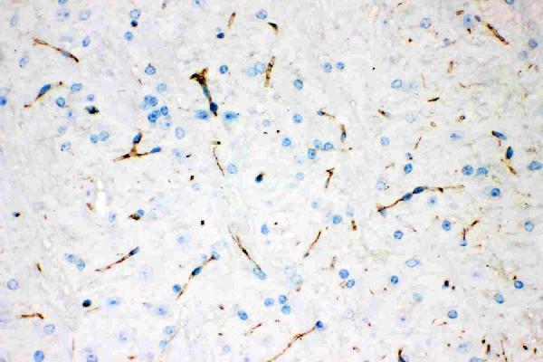 Anti-Tyrosine Hydroxylase Antibody (Monoclonal, TH-16)