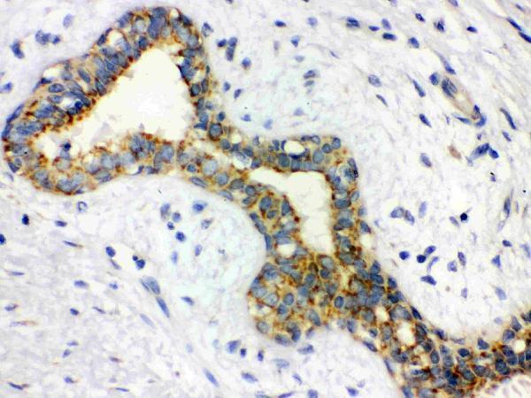 Anti-Alpha-Actinin ACTN2 Antibody (Monoclonal, EA-53)