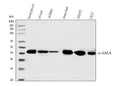 Anti-Alpha-Smooth Muscle Actin ACTA2 Antibody (Monoclonal, 1A4)