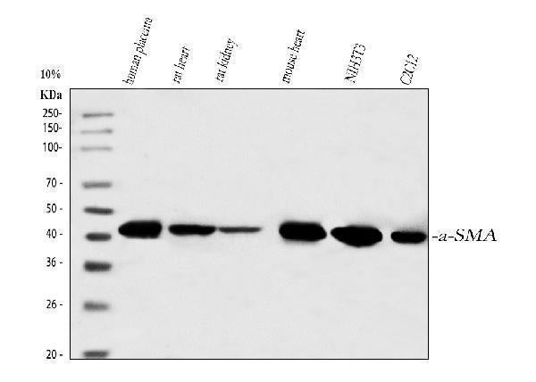 Anti-Alpha-Smooth Muscle Actin ACTA2 Antibody (Monoclonal, 1A4)