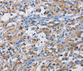 RICTOR Polyclonal Antibody – Figure 1 of 3
