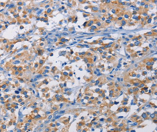 RICTOR Polyclonal Antibody – Figure 1 of 3