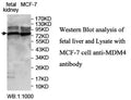 Anti-MDM4 Antibofy Antibody – Figure 1 of 1