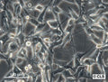 FO-1 (MEL-CLS-1) cell