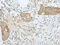 SNRPD1 Polyclonal Antibody – Figure 1 of 3