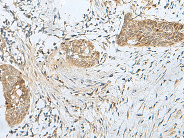 SNRPD1 Polyclonal Antibody – Figure 1 of 3