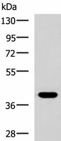 PLPPR5 Polyclonal Antibody – Figure 1 of 3