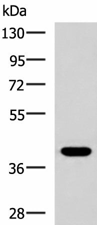 PLPPR5 Polyclonal Antibody – Figure 1 of 3