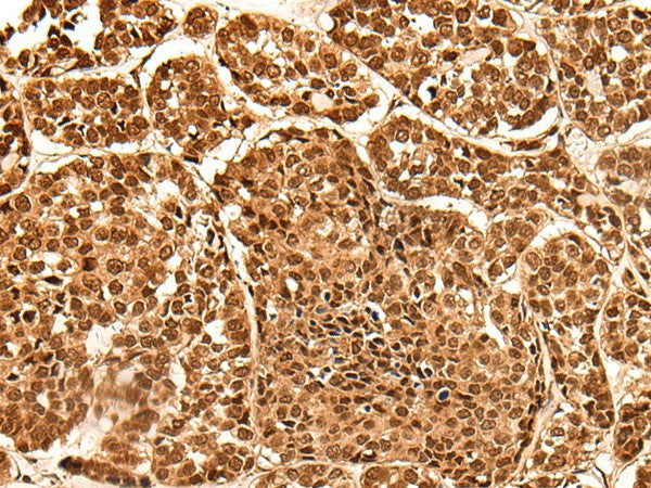 NEK7 Polyclonal Antibody – Figure 1 of 3