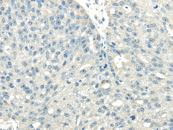 VPS36 Polyclonal Antibody – Figure 1 of 3