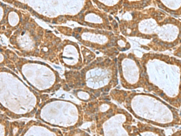 KIF2A Polyclonal Antibody – Figure 1 of 2