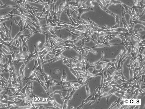 MML-1 cell