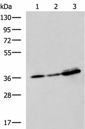 EEF1D Polyclonal Antibody – Figure 1 of 4