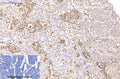 CD15 Monoclonal Antibody – Figure 1 of 3