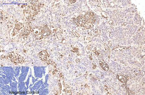 CD15 Monoclonal Antibody – Figure 1 of 3
