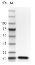 Mouse FGF-21 Protein,ÿ His tag (Animal-Free)