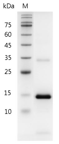 Mouse IL-21 Protein, His tag (Animal-Free)