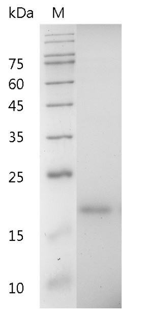 Mouse IL-33 Protein,ÿ His tag (Animal-Free)
