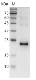 Mouse LIF Protein,ÿ His tag (Animal-Free)