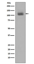 Western blot analysis of JAK2 phosphorylation expression in Jurkat cell lysates treated with Pervanadate.