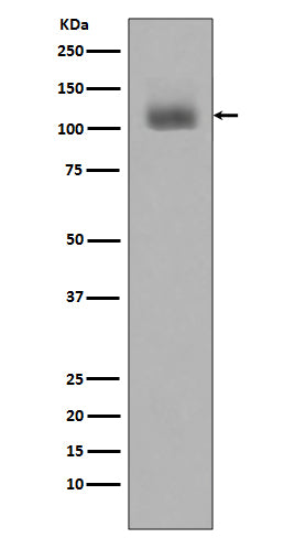 Western blot analysis of JAK2 phosphorylation expression in Jurkat cell lysates treated with Pervanadate.