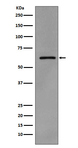 Western blot analysis of Phospho-Src (Y419) expression in A431 cell lysate treated with pervanadate.