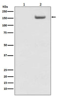 Western blot analysis of Phospho-SMC1 (S957)  expression in (1) HeLa cell lysate; (2) Hela cells lysate treated with AP.
