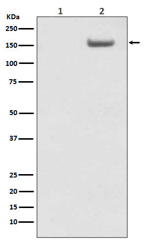 Western blot analysis of Phospho-SMC1 (S957)  expression in (1) HeLa cell lysate; (2) Hela cells lysate treated with AP.