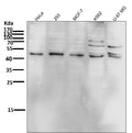 Anti-Phospho-JNK1/2/3 (T183+T183+T221) MAPK8 Monoclonal Antibody
