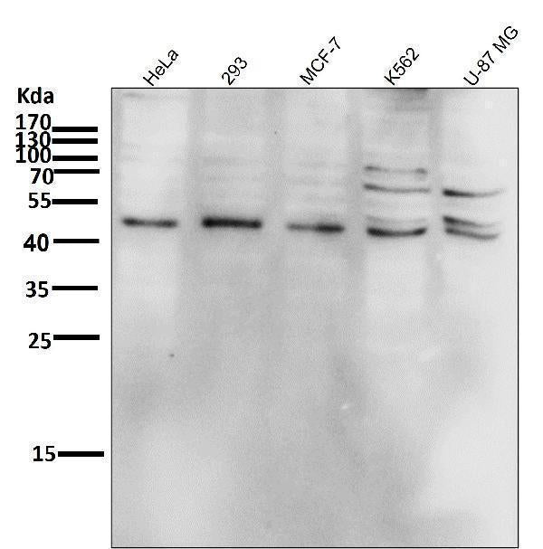 Anti-Phospho-JNK1/2/3 (T183+T183+T221) MAPK8 Monoclonal Antibody