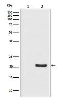Western blot analysis of Phospho-Bad (S112) expression in (1) HeLa cell lysate; (2) HeLa cell treated with Calcyculin A lysate.
