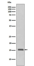 Western blot analysis of Phospho-Histone H3 (Thr3) in HeLa cell lysates treated with FBS + Calyculin A.