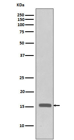 Western blot analysis of Phospho-Histone H3 (Thr3) in HeLa cell lysates treated with FBS + Calyculin A.