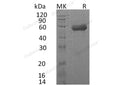 Recombinant Human IL18RAP/IL1R7 Protein (His Tag) – Figure 1 of 2