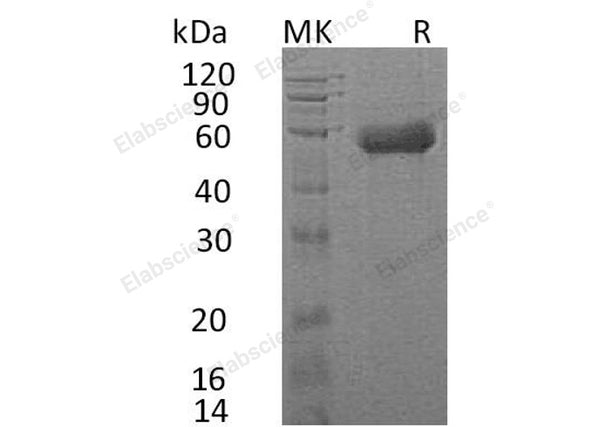 Recombinant Human IL18RAP/IL1R7 Protein (His Tag) – Figure 1 of 2