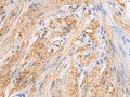 TMOD3 Polyclonal Antibody – Figure 1 of 2