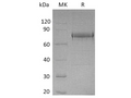 Recombinant Human EphA1 Protein (His Tag) – Figure 1 of 2