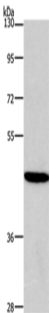 HDAC8 Polyclonal Antibody – Figure 1 of 4