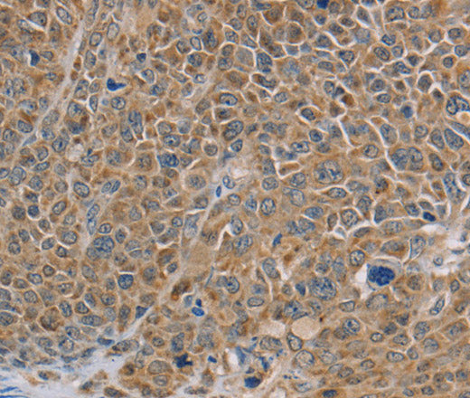 NDUFS7 Polyclonal Antibody – Figure 1 of 2