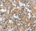 CREB2 Polyclonal Antibody – Figure 1 of 3