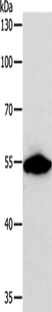 CALR Polyclonal Antibody – Figure 1 of 4