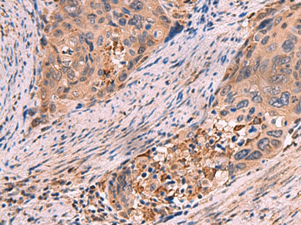 SHC4 Polyclonal Antibody – Figure 1 of 2