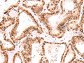 TOR1AIP1 Polyclonal Antibody – Figure 1 of 2